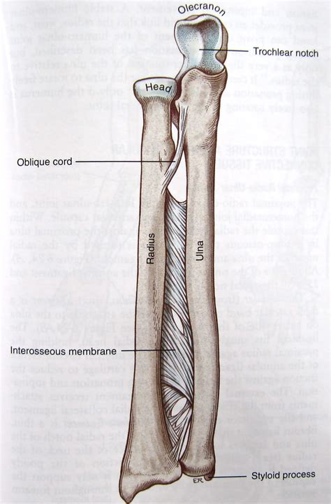 test for forearm interosseous membrane tear|interosseous membrane injury forearm.